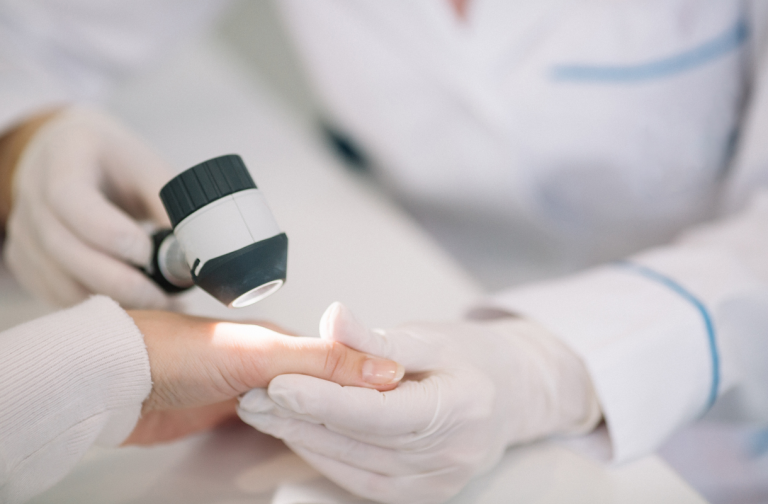 Dermatologia com Bradesco Saúde Cobre seus Tratamentos
